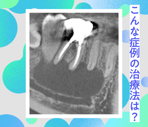 突然ですが質問です。<br>「Q.こんな症例、どう処置しますか？」