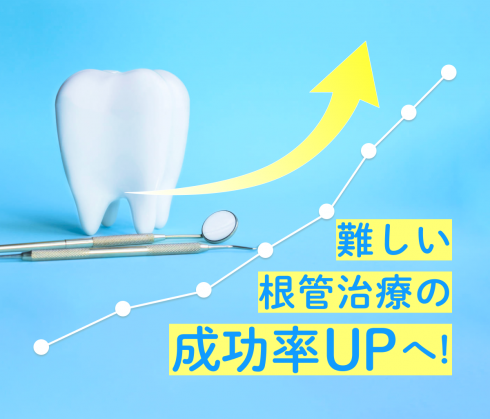 簡単！速い！「根管治療」のハードルを下げる新たな選択肢とは？