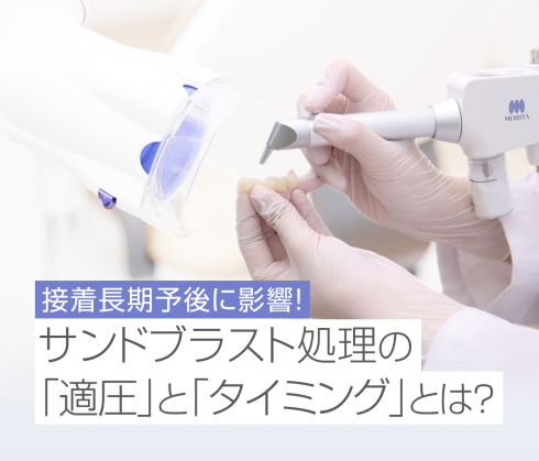 接着長期予後に影響！<br>サンドブラスト処理の「適圧」と「タイミング」とは？