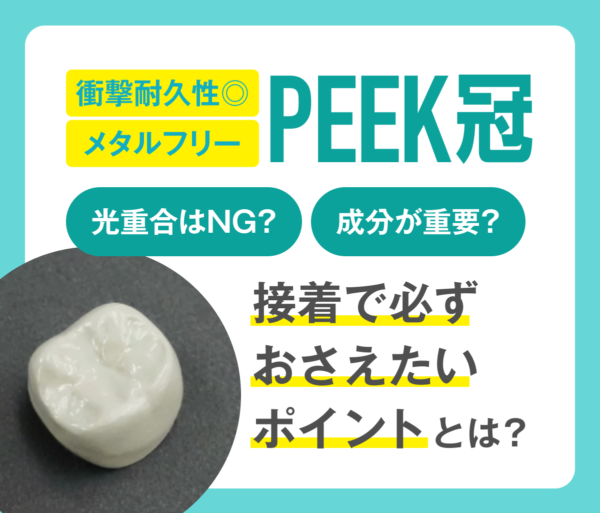 モリタ】【症例増加中】PEEK冠接着の際、必ず気をつけたいポイントとは
