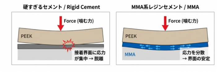 固すぎるセメントとMMA系レジンセメントの比較