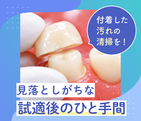 試適後、そのまま接着していませんか？接着前に確認したい「清掃」のポイント