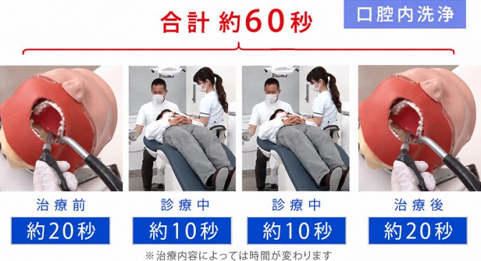 口腔内洗浄 合計 約60秒の内容